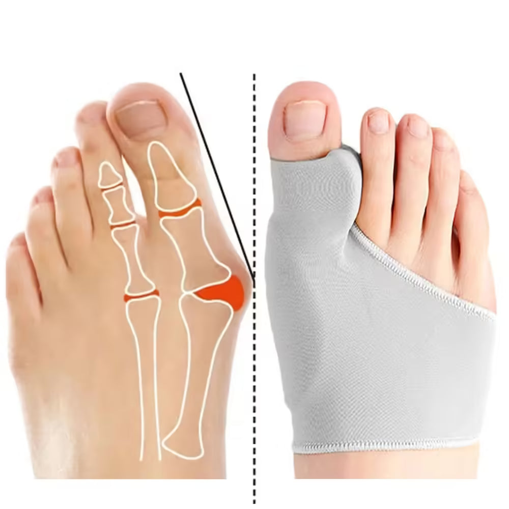 Toe Separator Bunion Corrector Orthotics - Hallux Valgus Feet Bone Adjuster Pedicure Sock Straightener