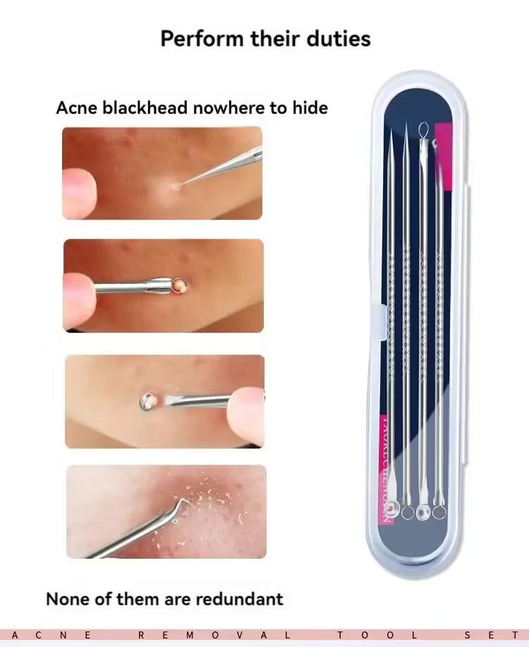 مجموعة إزالة الرؤوس السوداء وحب الشباب من 4 قطع - أداة للعناية بالبشرة للنساء - علاج حب الشباب وتنظيف المسام