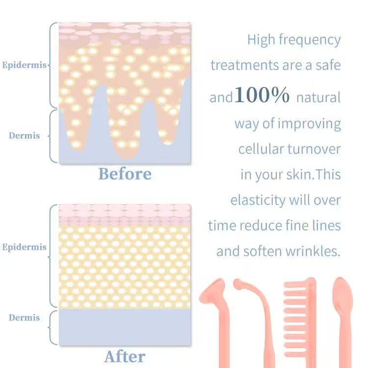 Portable Handheld High Frequency Skin Therapy Wand Machine - Acne Treatment, Skin Rejuvenation, Wrinkle Reduction Tool