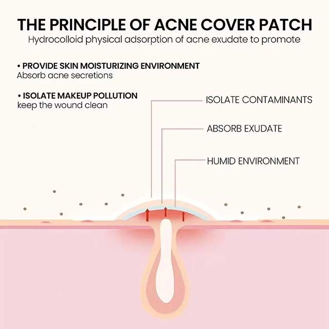 Facial Acne Patch – Spot Treatment for Pimple Marks, Blemishes & Skin Repair Care