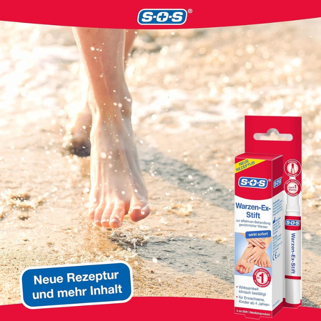 SOS Wart-Ex Pen – Instant-Acting Wart Removal Treatment for Common Warts