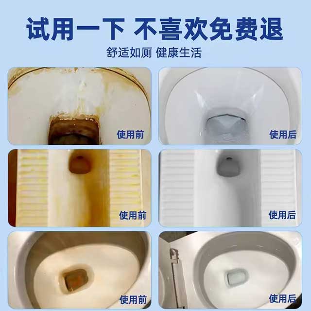 Household Urine-Alkali Dissolver Toilet Cleaner – Powerful Descaling Agent for Yellow Urine Stain Removal