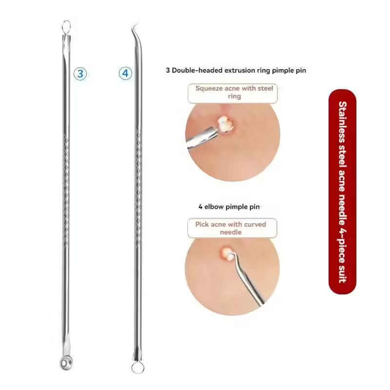 مجموعة إزالة الرؤوس السوداء وحب الشباب من 4 قطع - أداة للعناية بالبشرة للنساء - علاج حب الشباب وتنظيف المسام 