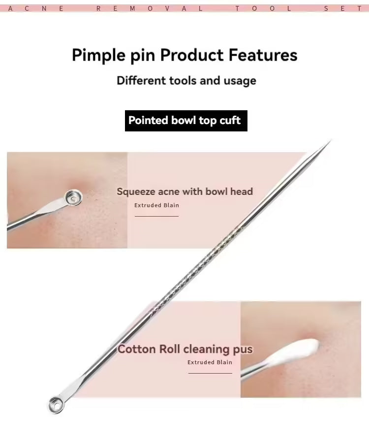 مجموعة إزالة الرؤوس السوداء وحب الشباب من 4 قطع - أداة للعناية بالبشرة للنساء - علاج حب الشباب وتنظيف المسام 