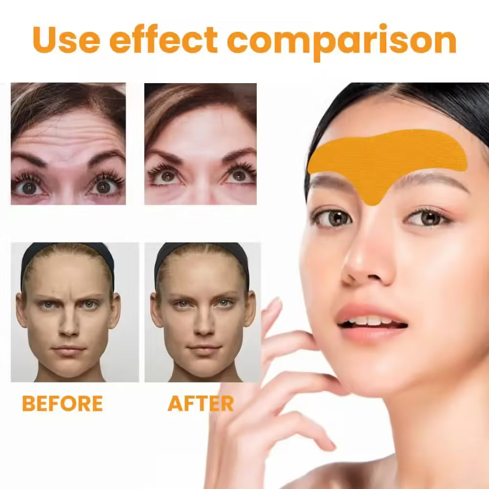Anti-wrinkle forehead gel patch 10 pcs set