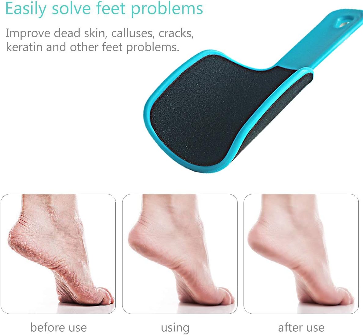 U-Shaped Curved Foot File – Double-Sided Callus Remover & Dead Skin Scrubber – Professional Pedicure Tool for Smooth Heels & Soles (Green/Pink/Blue/Black)