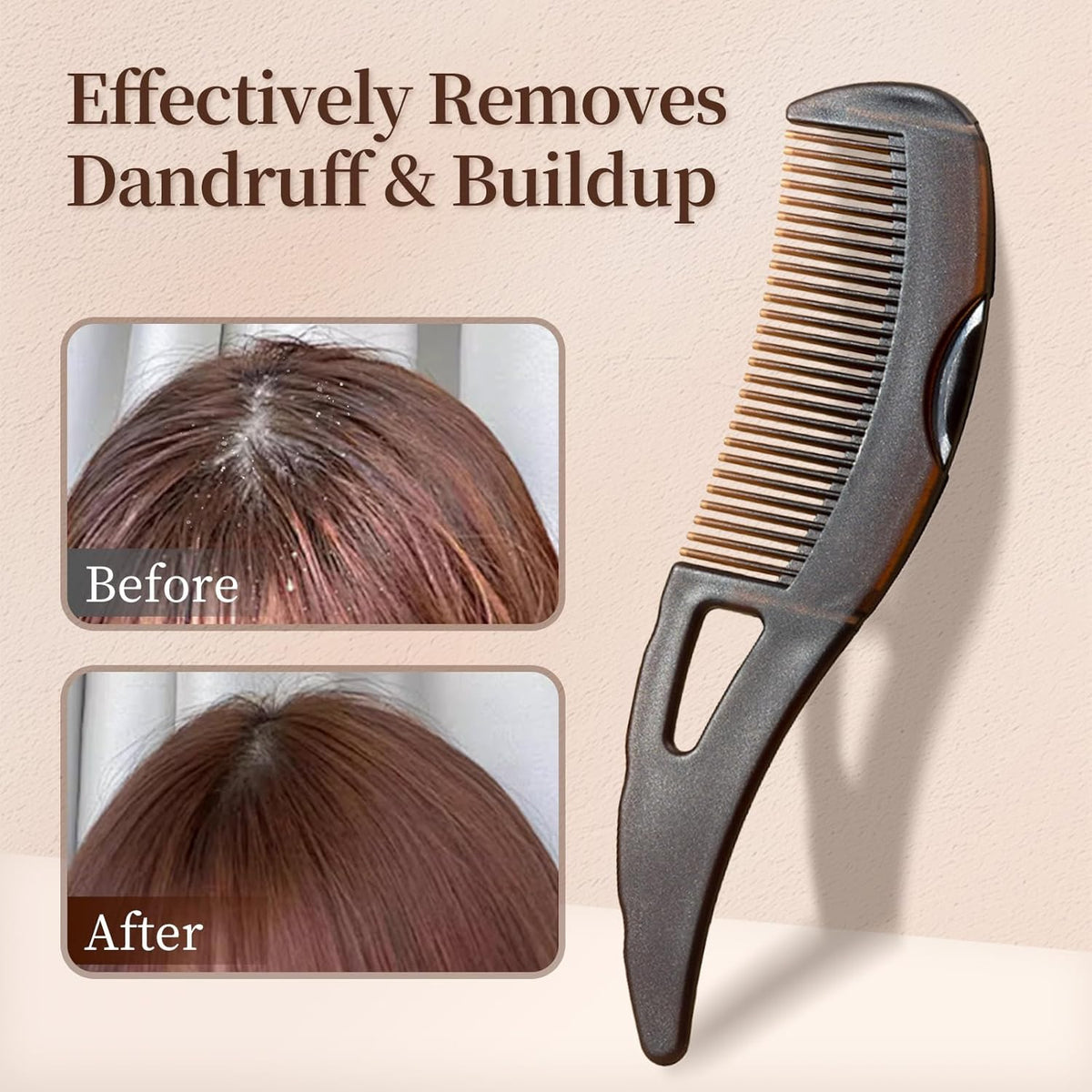 Brosse de massage auto-nettoyante pour le cuir chevelu – Peigne antistatique anti-pellicules – Outil professionnel de coiffure et de mise en forme pour une croissance saine des cheveux