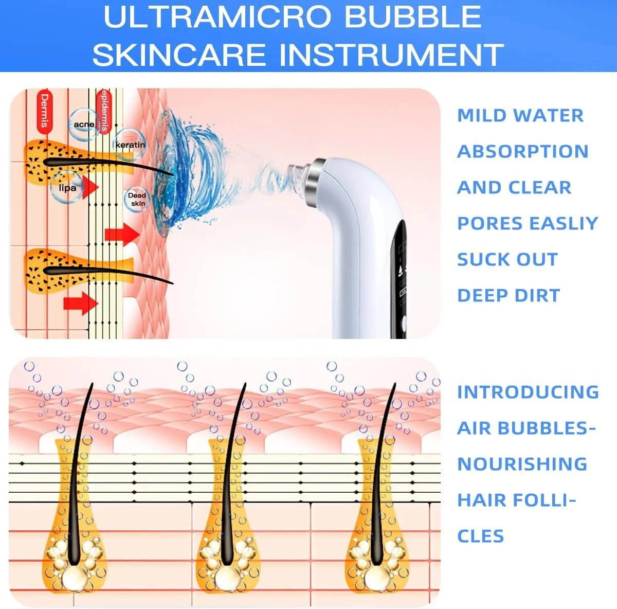 Hydra Facial Blackhead Remover Vacuum – USB Rechargeable Water Cycle Pore Cleaner with 3 Suction Modes & 6 Suction Heads