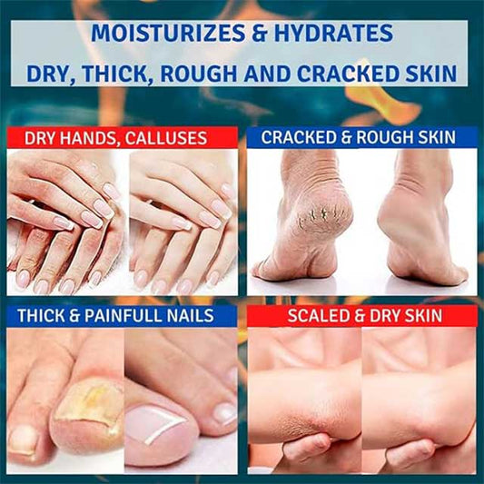 Deep Moisturizing Repair for Cracked