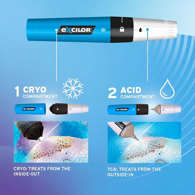 Excilor 2-In-1 Dual Action Freeze &amp; Gel Wart and Verruca Remover – Fast 5-Day Hand &amp; Foot Treatment for Adults &amp; Kids 4+