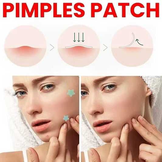 Facial Acne Patch – Spot Treatment for Pimple Marks, Blemishes & Skin Repair Care