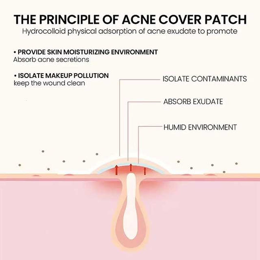 Facial Acne Patch – Spot Treatment for Pimple Marks, Blemishes & Skin Repair Care