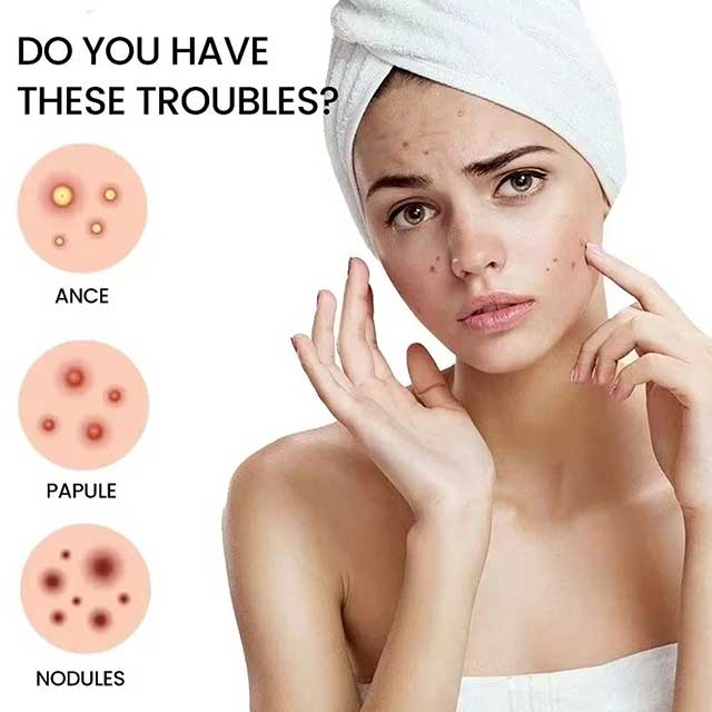 Facial Acne Patch – Spot Treatment for Pimple Marks, Blemishes & Skin Repair Care