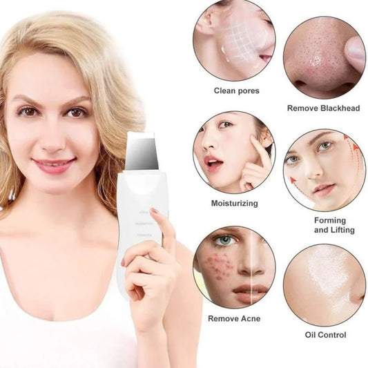 Ultrasonic Skin Scrubber Facial Spatula – USB Rechargeable Blackhead Remover & Deep Pore Cleansing Device