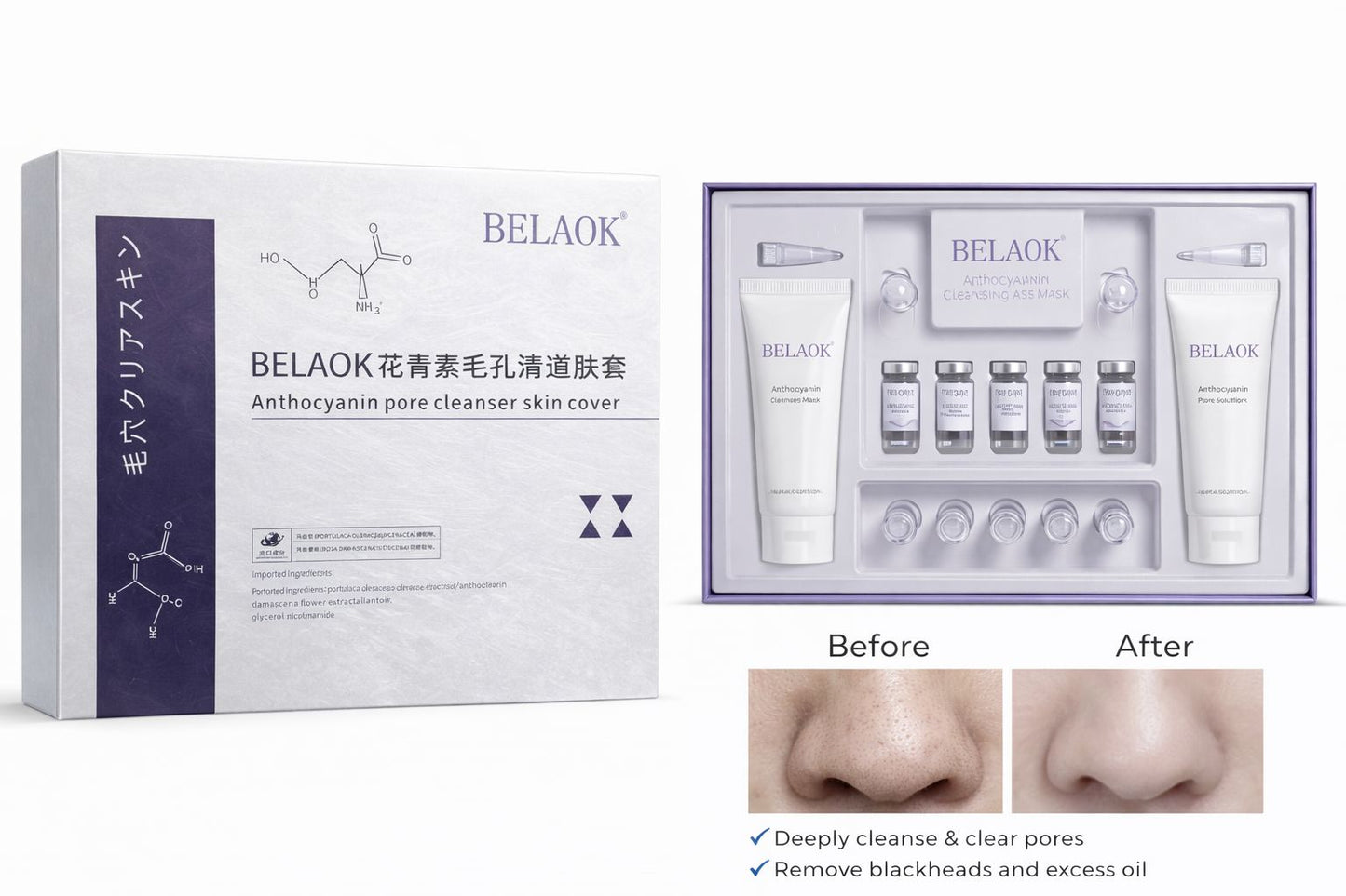 Pore Cleansing Facial Kit | Deep Clean & Blackhead Removal Set