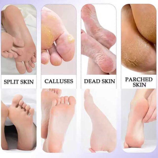 10-in-1 Pedicure Set - Stainless Steel Double-Sided Foot Scrubbing Brush, Callus Remover & Exfoliator for Smooth Feet - Peeling & Foot Care Pedal Stone