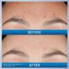 CeraVe Resurfacing Retinol Serum for Post Acne Marks