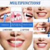 Advanced Tooth Stain Remover & Tartar Eraser Kit – Professional Dental Plaque Cleaning & Teeth Whitening Tool - Image 3