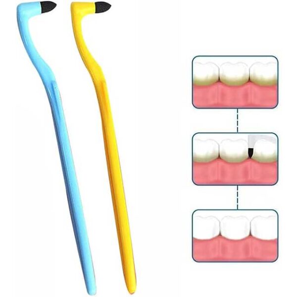 Advanced Tooth Stain Remover & Tartar Eraser Kit – Professional Dental Plaque Cleaning & Teeth Whitening Tool - Image 2